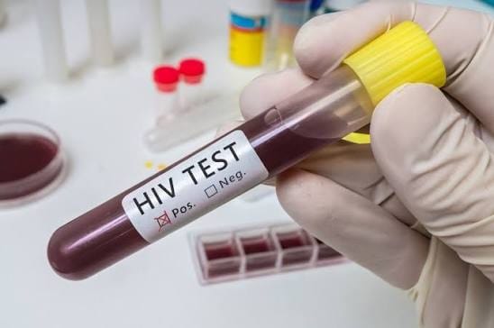 Avanços contra a Aids entram em risco e Brasil registra aumento de novos casos de HIV