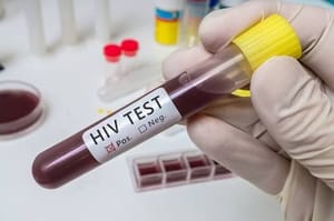 Avanços contra a Aids entram em risco e Brasil registra aumento de novos casos de HIV